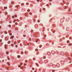 Bad news/good news about the hantavirus outbreak – FIT IS A FEMINIST ISSUE
