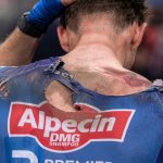 Huge crash sees Kaden Groves hit the deck in opening sprint of Giro d’Italia 2026