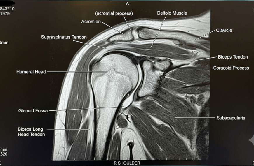 Deny Pain, Heal Faster; if only … – FIT IS A FEMINIST ISSUE